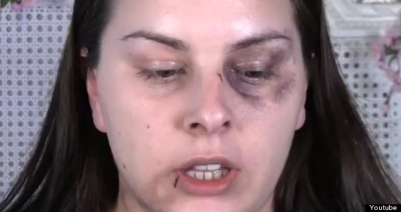 make up bruising