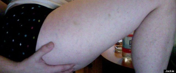 Women Real Thighs570 Women Real Thighs570