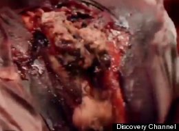 WEIRD SCIENCE: Shooting Victim Held Captive By His Own Doctor Unwillingly Aids In Medical Milestone