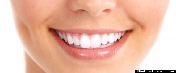 Sourire
