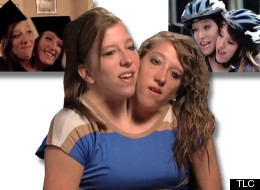 Conjoined, in Marriage?