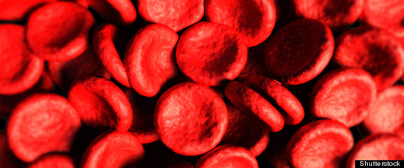 Blood Type Heart Disease