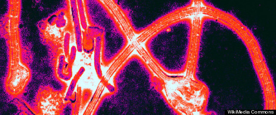 Ebola