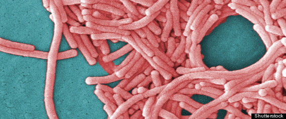 Legionnaires Disease