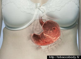 Is THIS What Your Body Looks Like On Tobacco? 