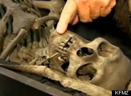 Bill Wood Buys Skeletons