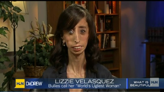 Lizzie Velasquez - www.jurukunci.net