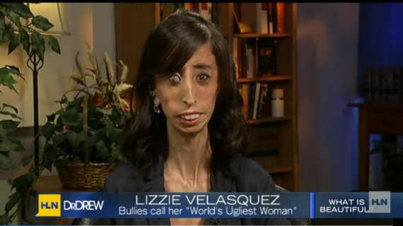 lizzie velasquez