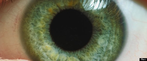 Eye