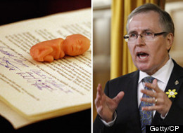 MP Makes Final Push For Debate On When Life Begins