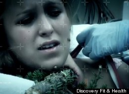 WATCH: Impaled By A Tree Branch