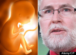 Tory MPs Clash With Opposition Over Definition Of Life