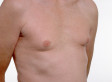 Male Breast Cancer Gene Clue (PLUS Cancer Breakthroughs PICTURES)