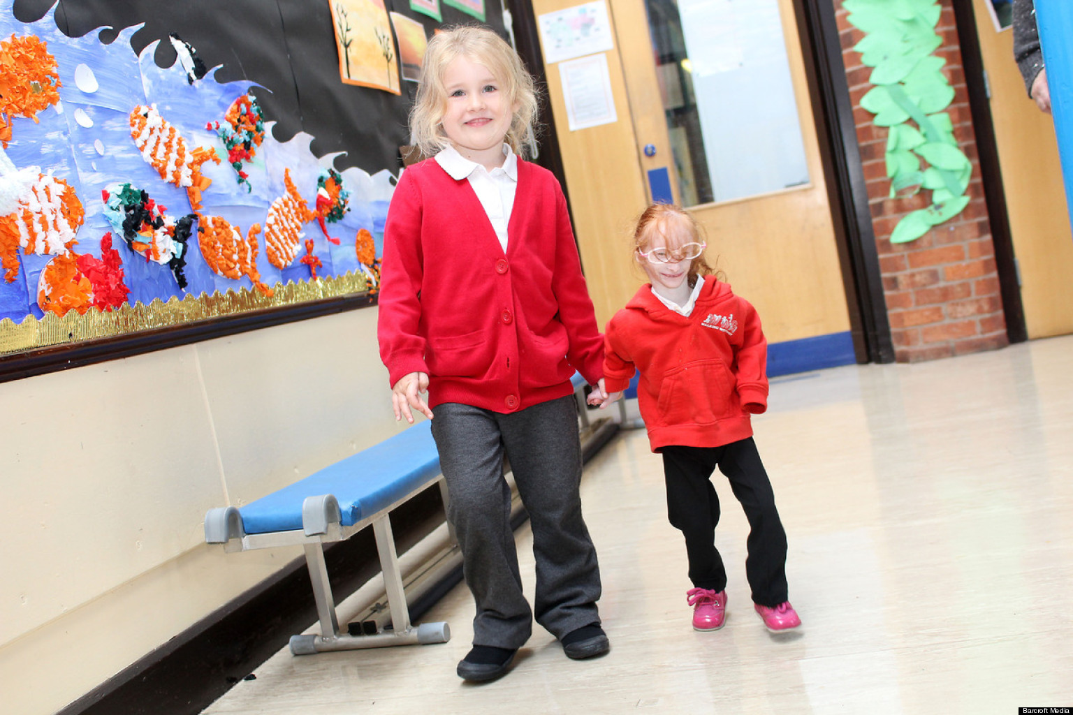 Charlotte Garside Girl 5 Born With Primordial Dwarfism Starts Primary