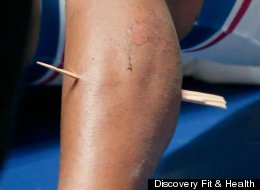 WATCH: Olympic Cyclist Impaled By Huge Splinter During A Race
