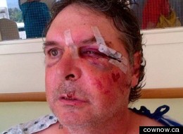 Man Allegedly Beaten By RCMP