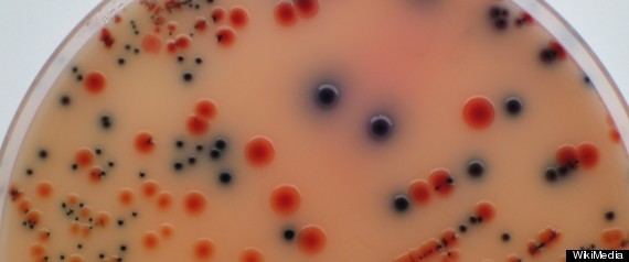 Food Safety Concern