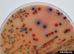 More E. Coli Linked To XL Foods Plant