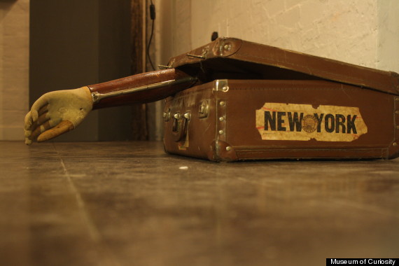 arm and suitcase