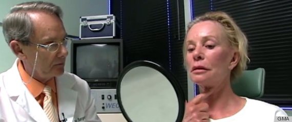 Motherdaughter Plastic Surgery
