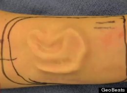6 Amazing Surgeries That Will Blow Your Mind