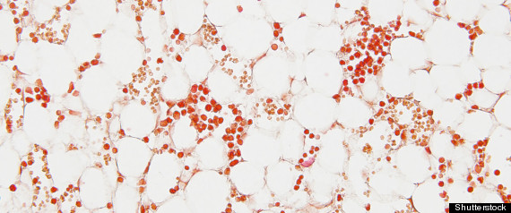 Bone Marrow