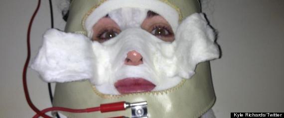 Kyle Richards Facial