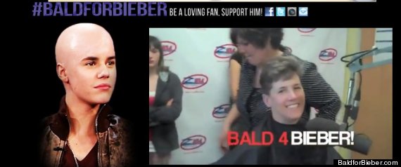 Bald For Bieber