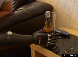 World's Most Amazing Prosthetic Arm