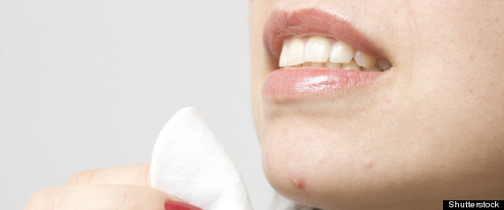 Acne Woman
