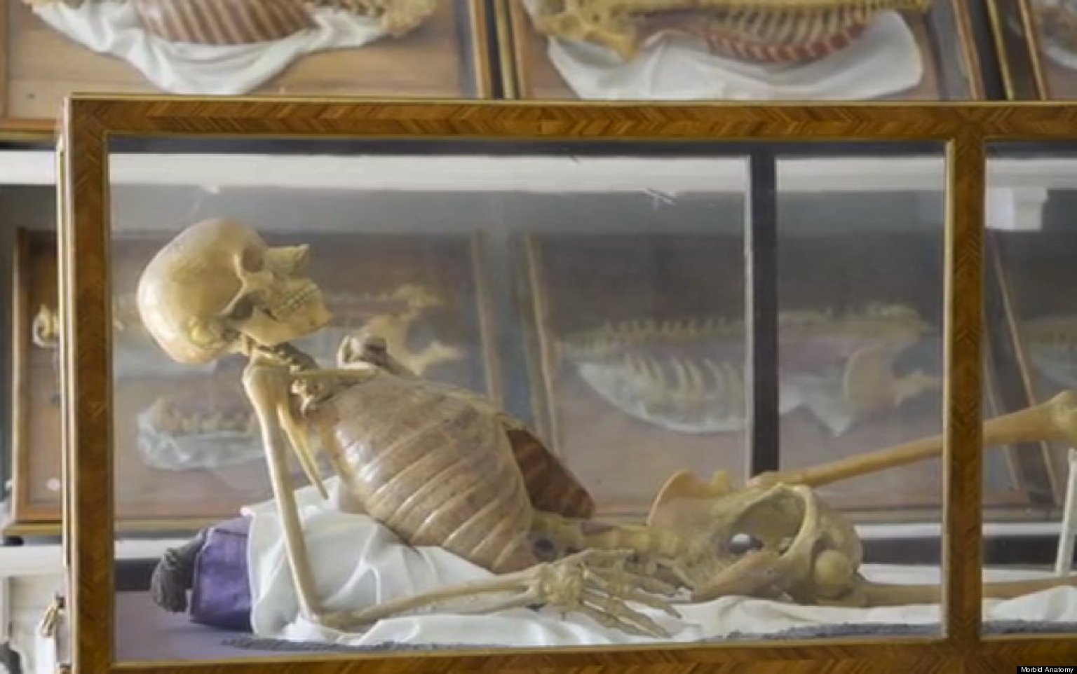 'Morbid Anatomy Anthology': Brooklyn Art Group Seeks Funding For
