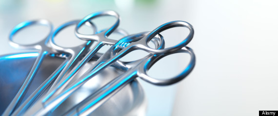 Vasectomy
