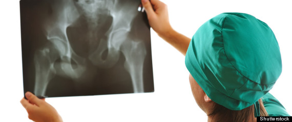 Genital Injuries