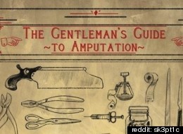 You Know, Should You Ever Need To Amputate Something