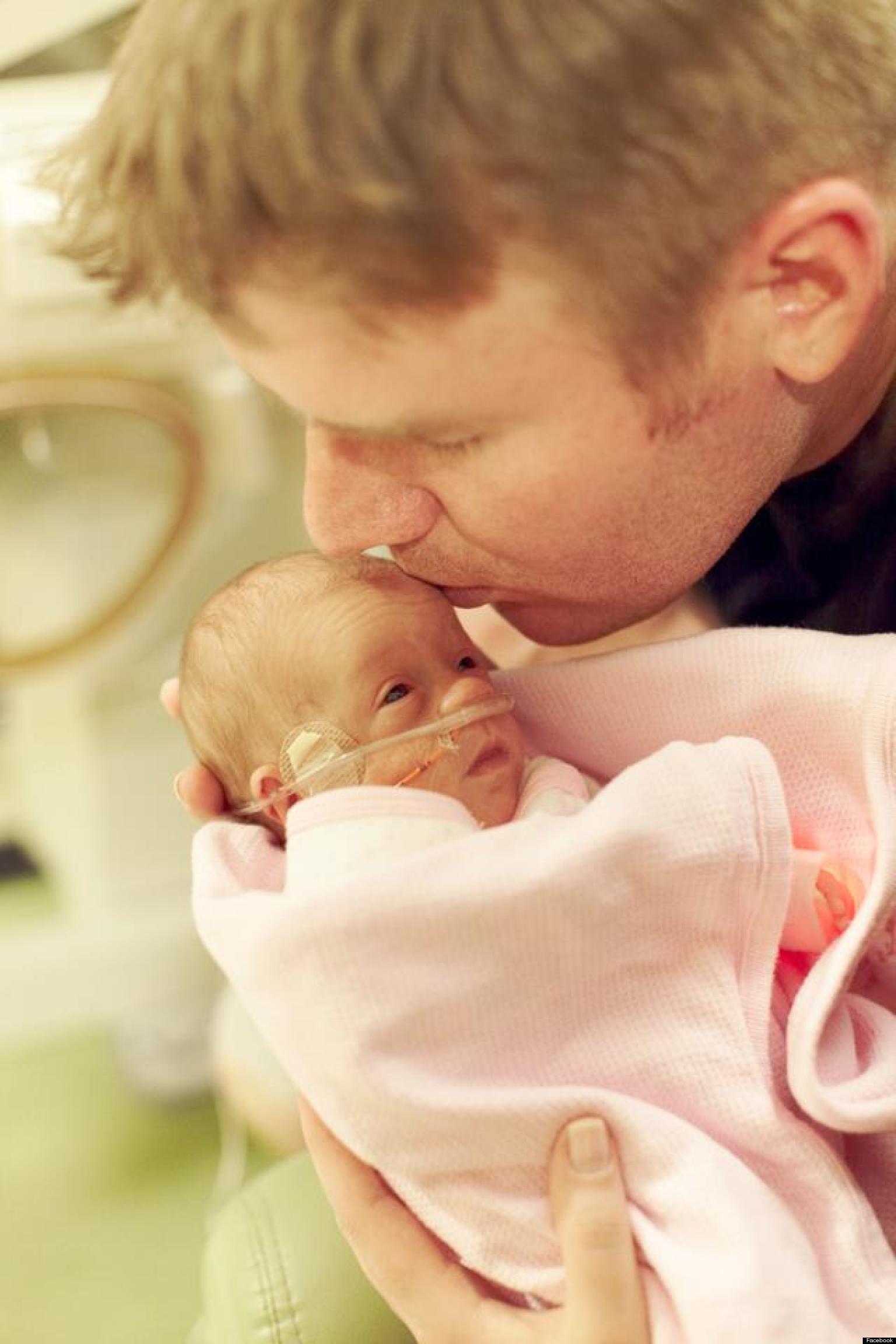 Ruby Love Lambright, Premature Baby Born At 1.6 Pounds ...
