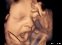 WATCH: Fetus Yawns Inside Womb