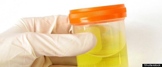Urine Cellules Souches