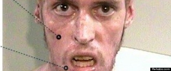 Horros Of Methamphetamine