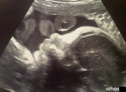 Esta es la primera foto del bebé de Shakira y Piqué