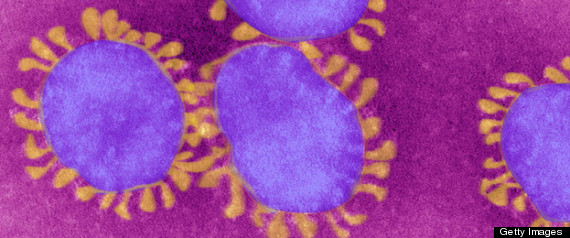 Coronavirus