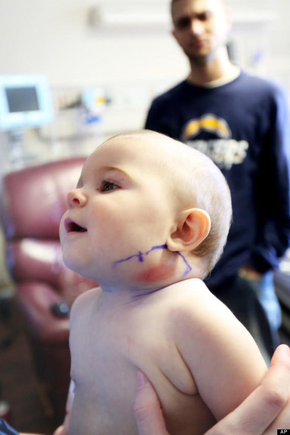 baby_swallowed_feather_2