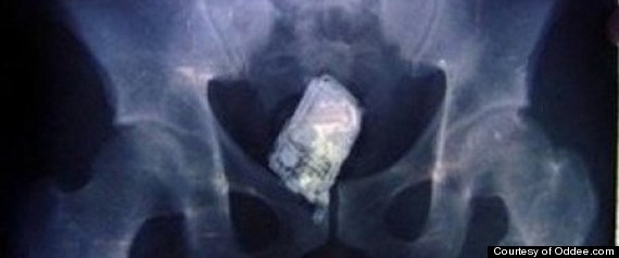 Big cock jerk off tits Crazy objects found in peoples asshole