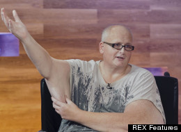 World's Fattest Man Loses 46 Stone