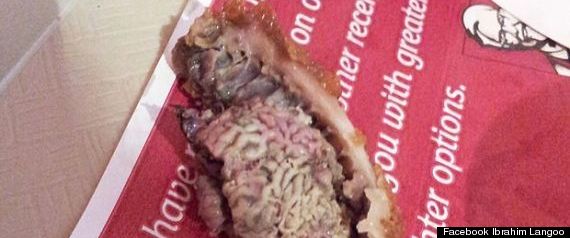 Cerebro