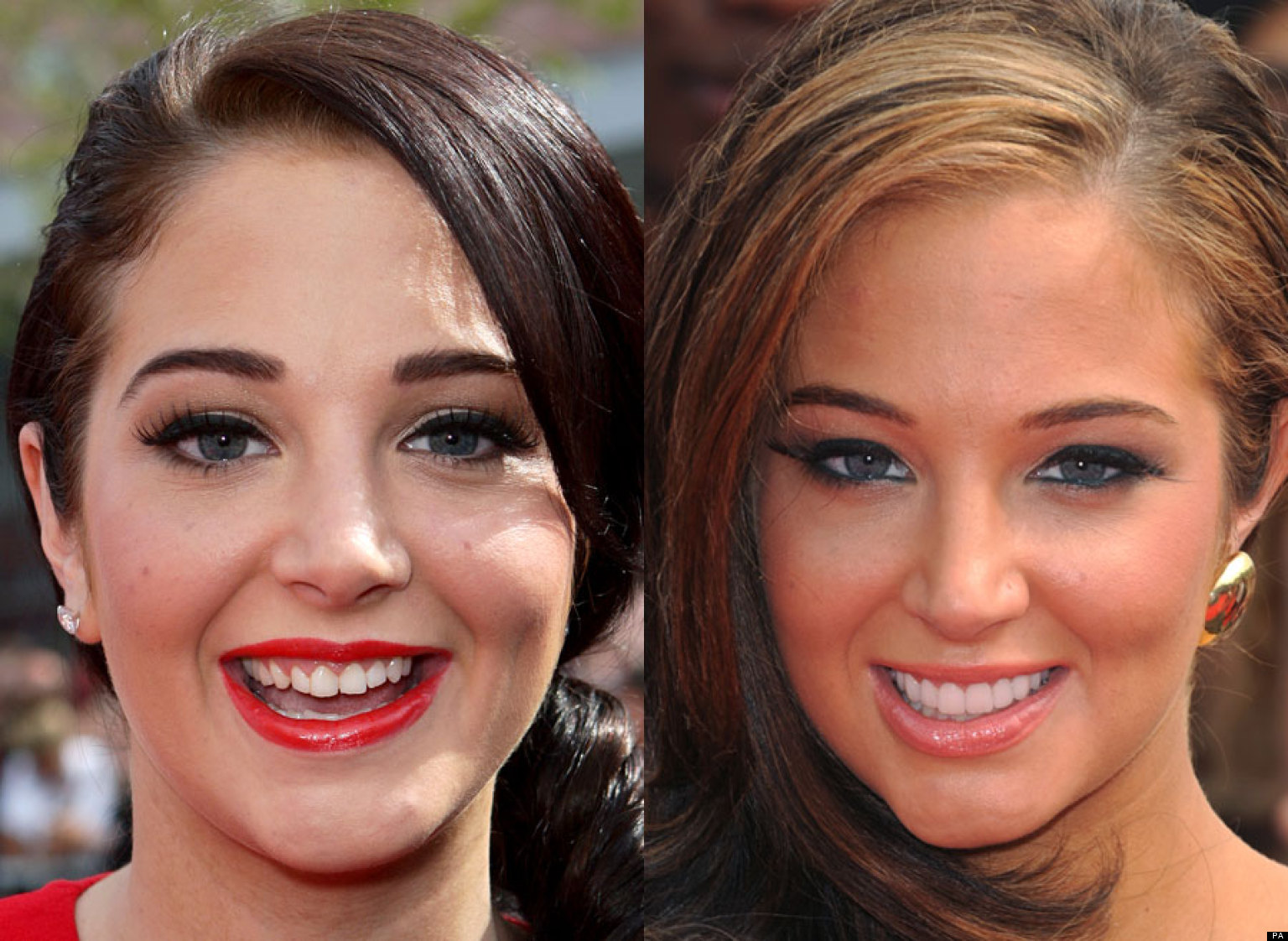 Celebrity Teeth Before And After: Stars Whove Had Dental Work 