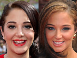Celeb Teeth: Before & After