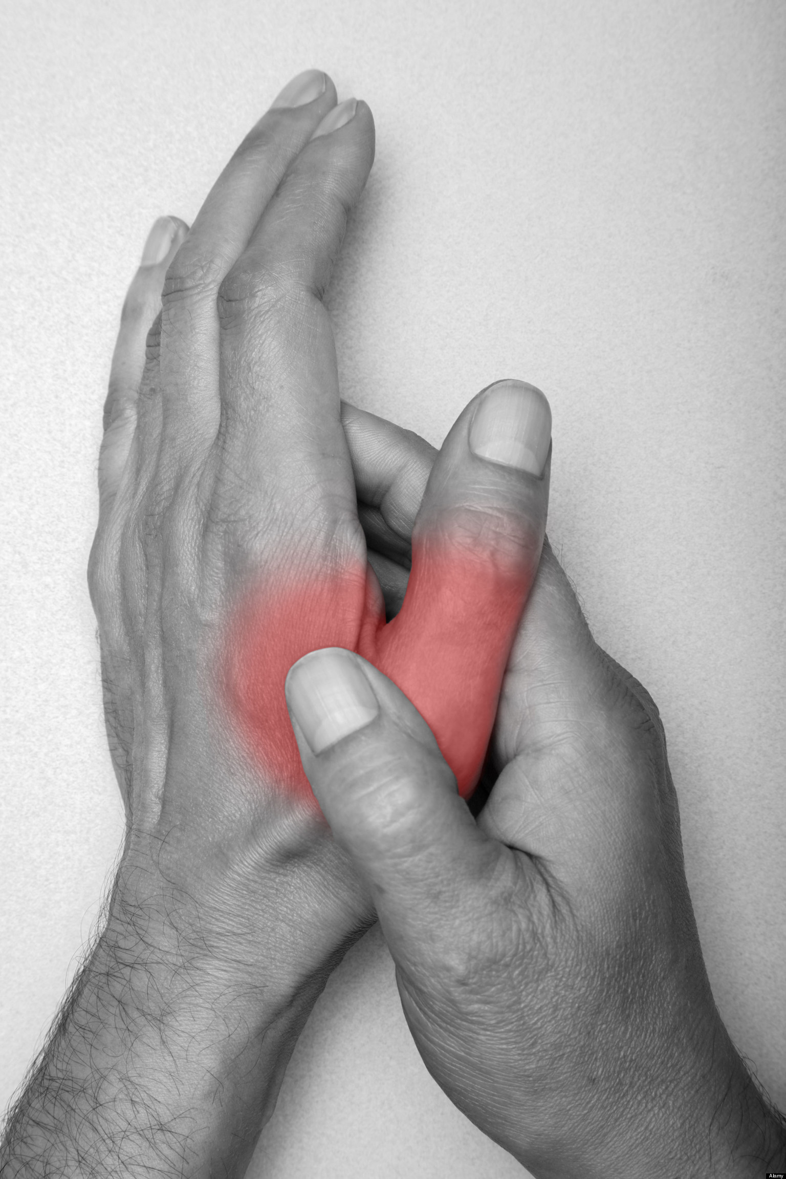 Arthritis singles