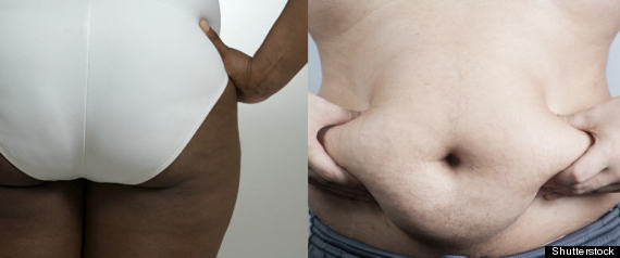 Belly And Thigh Fat