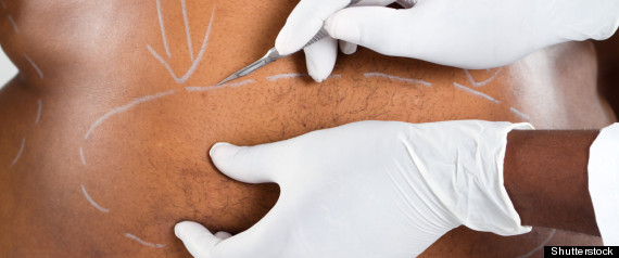 Surgical Procedure 2011