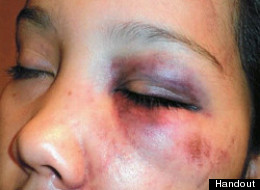 Mountie Cleared Of Teen Assault Charge